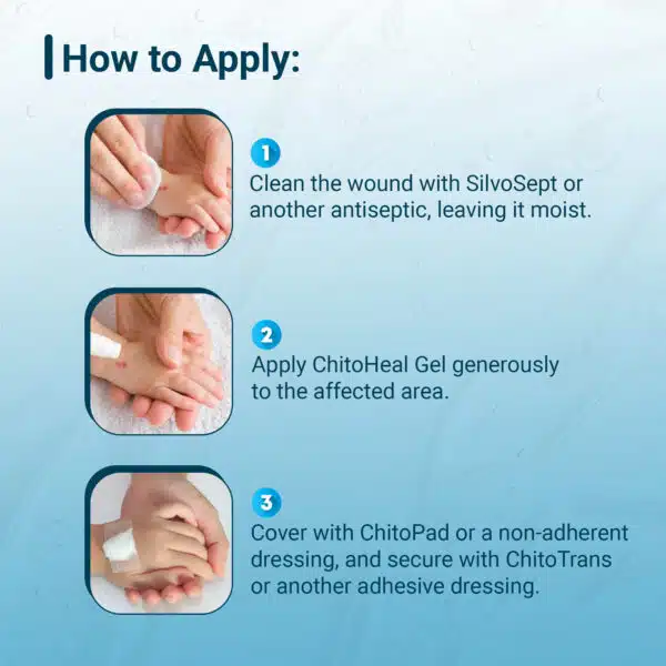 ChitoHeal Gel - Image 2