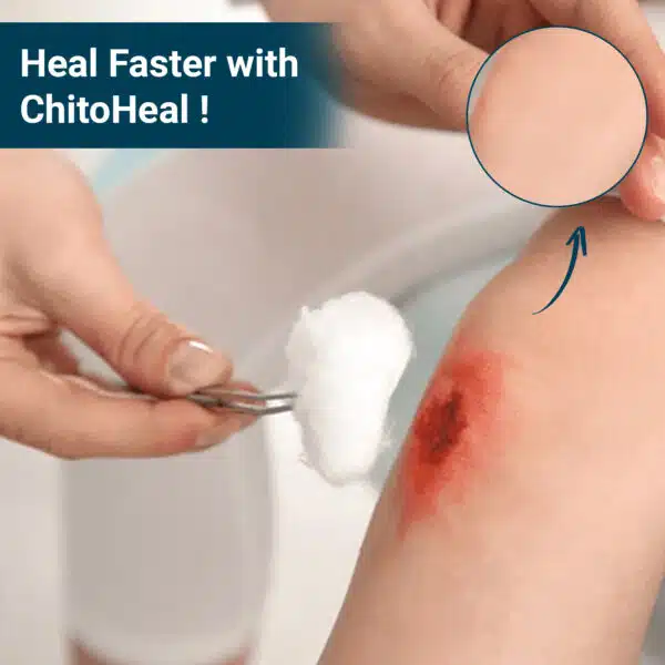 ChitoHeal Gel - Image 3